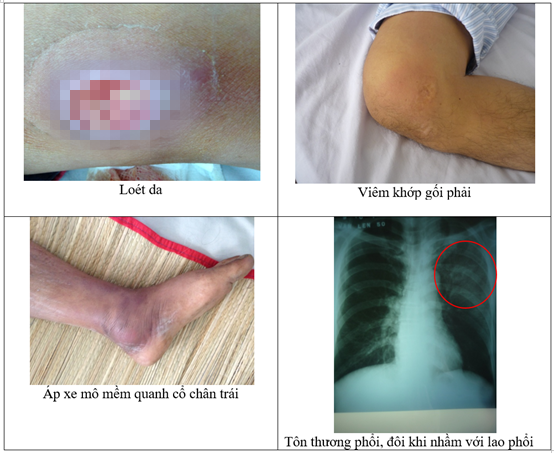 Sự thật khó ngờ về vi khuẩn "ăn thịt người"- Ảnh 9.