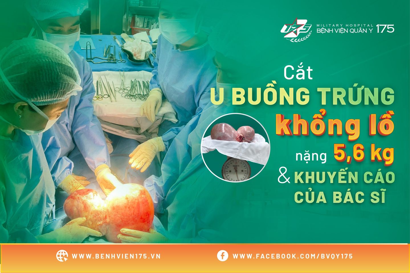 Khối u nặng gần 6kg chiếm toàn bộ bụng người phụ nữ