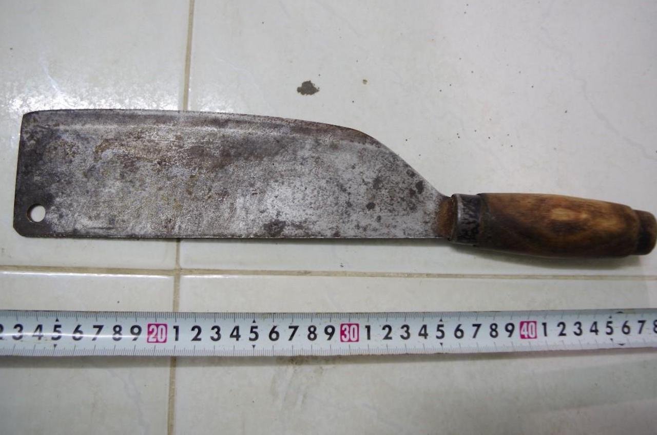 M&acirc;u thuẫn từ tiếng nẹt p&ocirc; xe, bị ch&eacute;m đứt l&igrave;a c&aacute;nh tay - Ảnh 2.