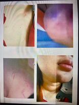 Nữ sinh lớp 12 ở TP HCM "tố" bị đánh hội đồng