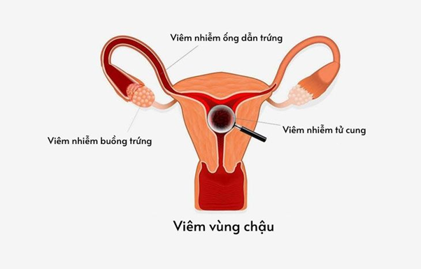 L&yacute; giải nguy&ecirc;n nh&acirc;n ra nhiều kh&iacute; hư c&oacute; m&ugrave;i h&ocirc;i - Ảnh 3.