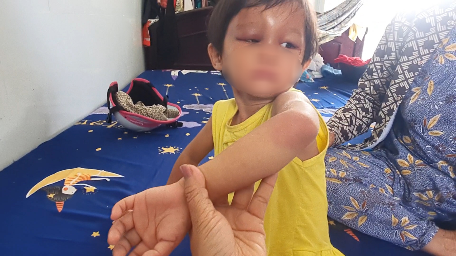 Làm rõ nguyên nhân bé gái 4 tuổi bị cha nuôi đánh đập dã man