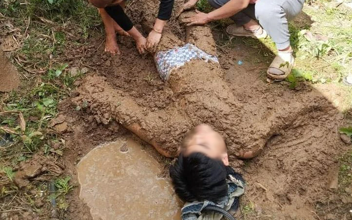 Em lao vào cứu anh trai bị điện giật, cả 2 bị thương nặng