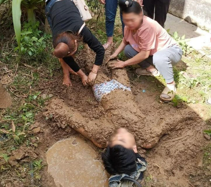 Em lao vào cứu anh trai bị điện giật, cả 2 bị thương nặng- Ảnh 1.