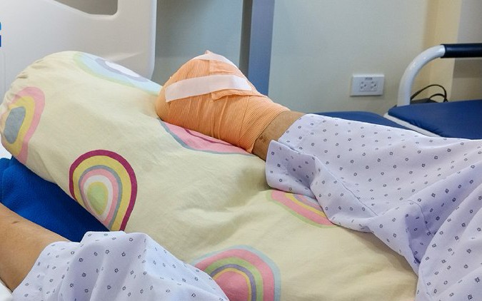 Người phụ nữ mất chân vì tự chích kim nặn mủ