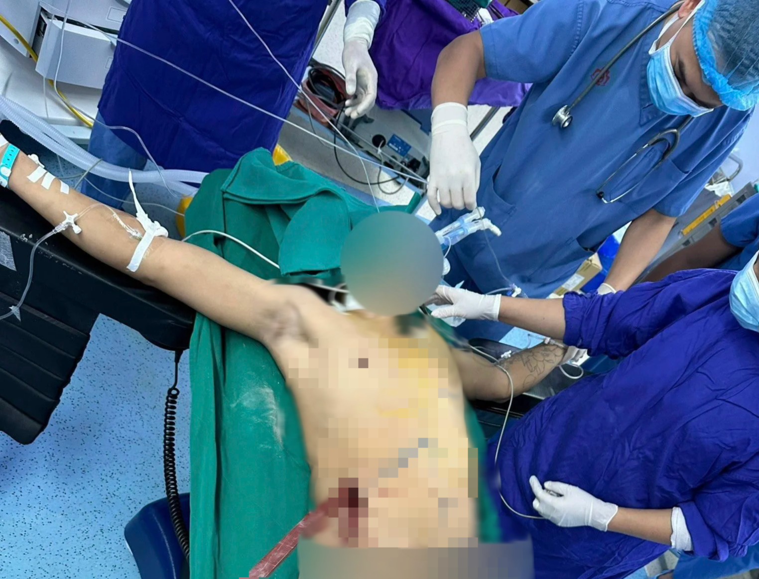 Hai thanh niên bị thanh sắt đâm, có người chờ trắng đêm mới được cứu- Ảnh 1.