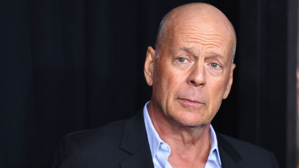 Siêu sao Bruce Willis bị mất trí nhớ sau bệnh mất ngôn ngữ