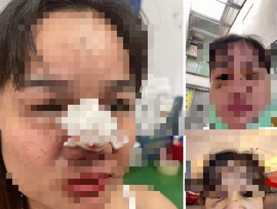 Người nổi tiếng kêu gọi từ thiện ở Quảng Nam bị "bóc phốt" ăn chặn tiền nói gì?