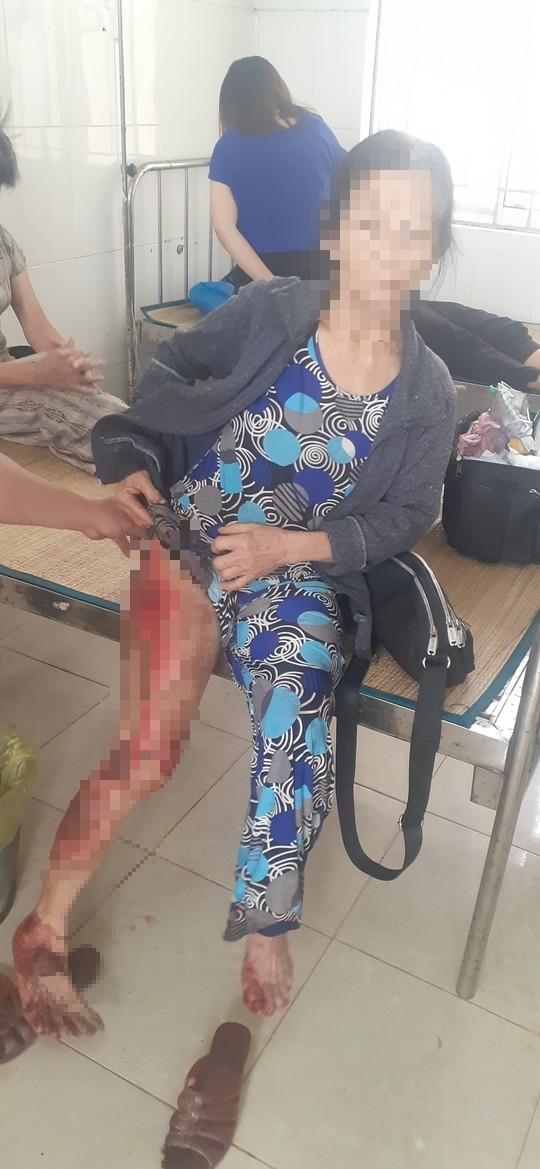 Nữ si&ecirc;u trộm m&oacute;c t&uacute;i của b&agrave; b&aacute;n rau, k&eacute;o l&ecirc; cả chục m&eacute;t - Ảnh 4.