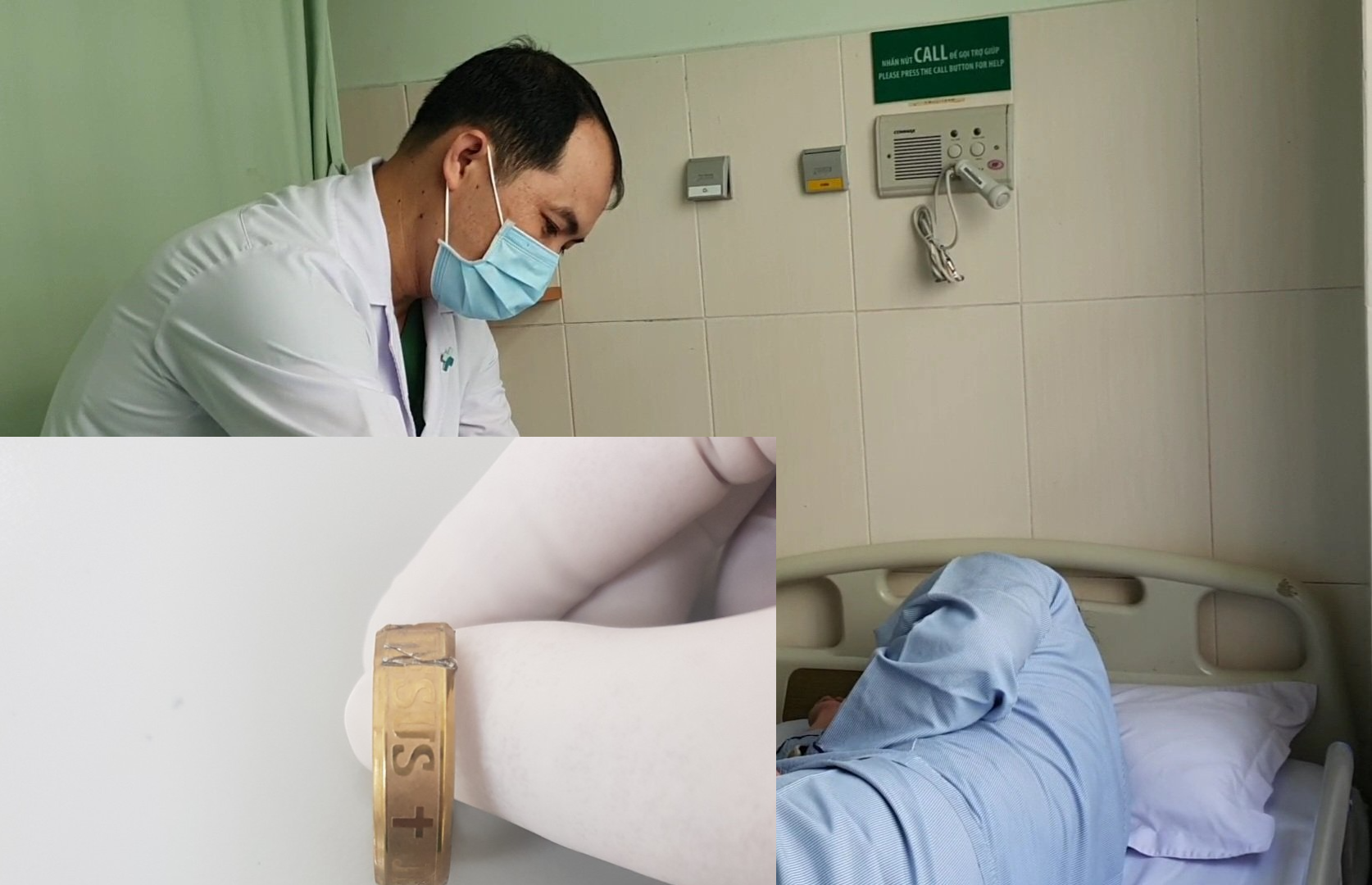 Nam thanh niên gặp nạn vì… đeo nhẫn vào dương vật