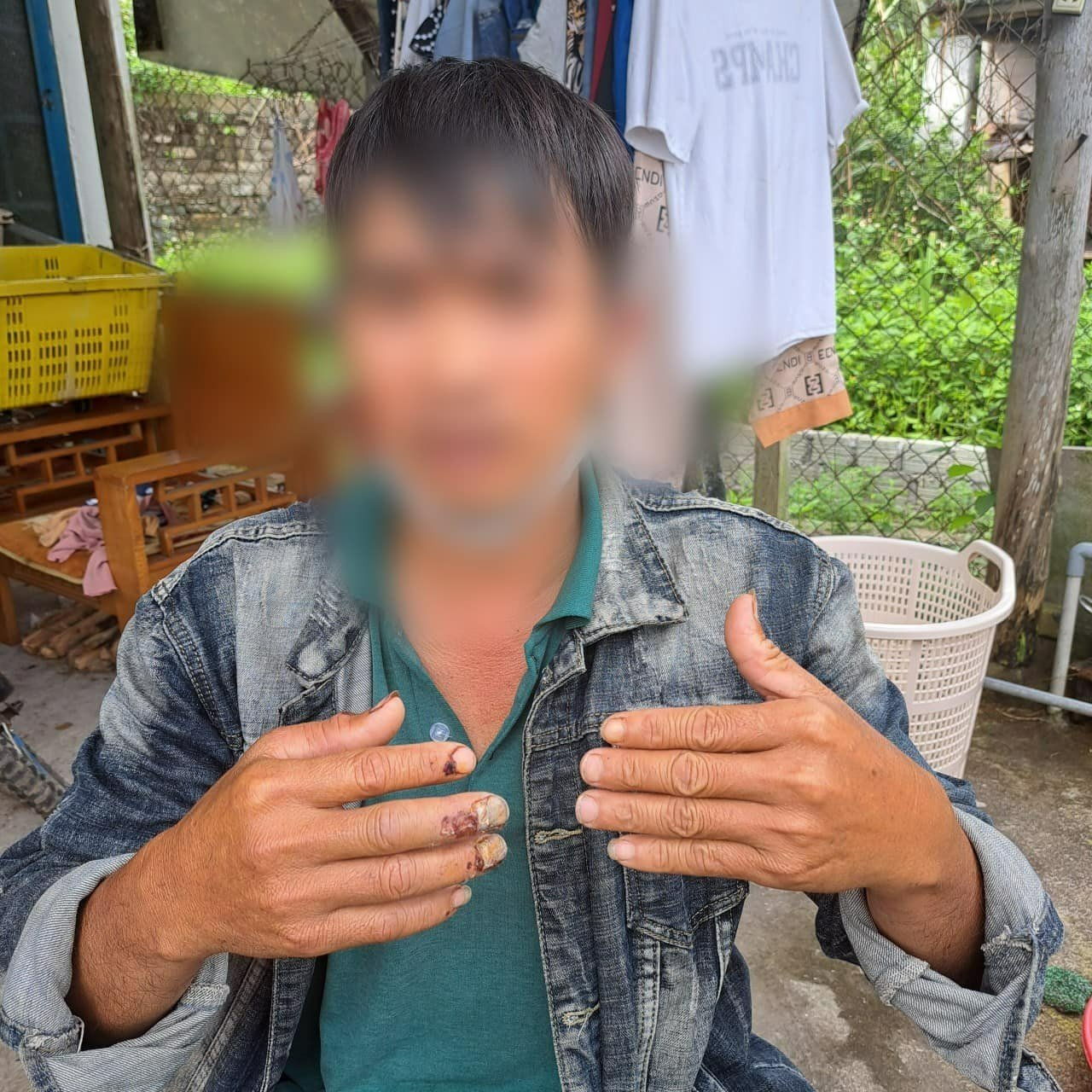 Nhẫn tâm đánh gục người khác chỉ để trộm một con gà