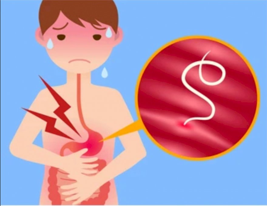 Những điều cần biết khi tẩy giun đường ruột cho trẻ