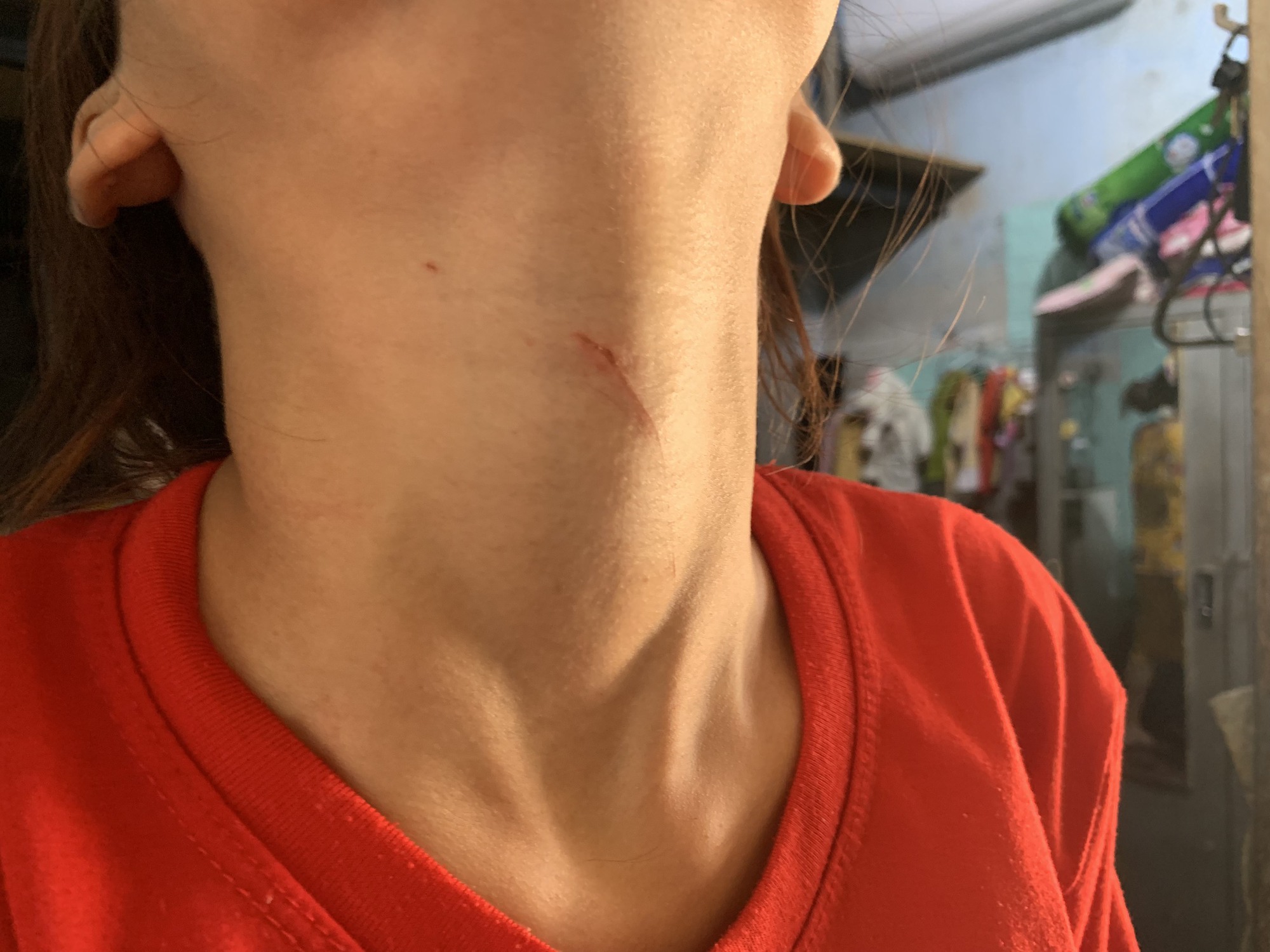 Cô gái ở TP HCM báo công an bị ép vào nhà vệ sinh cùng câu tao vã lắm rồi - Ảnh 2.