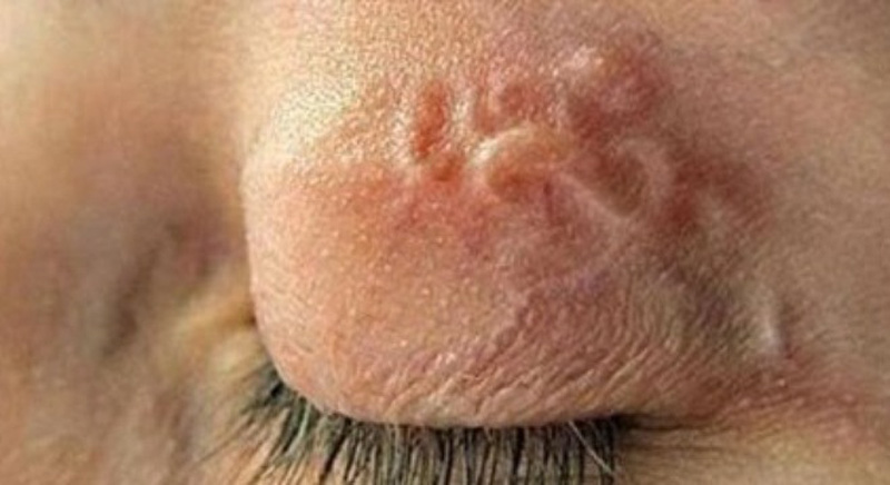 Dễ lây nhiễm giun sán từ thú cưng