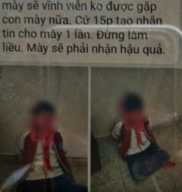 Bố đưa con gái tới nhà nghỉ trói tay, bịt mắt và miệng rồi hoang tin con bị bắt cóc - Ảnh 2.