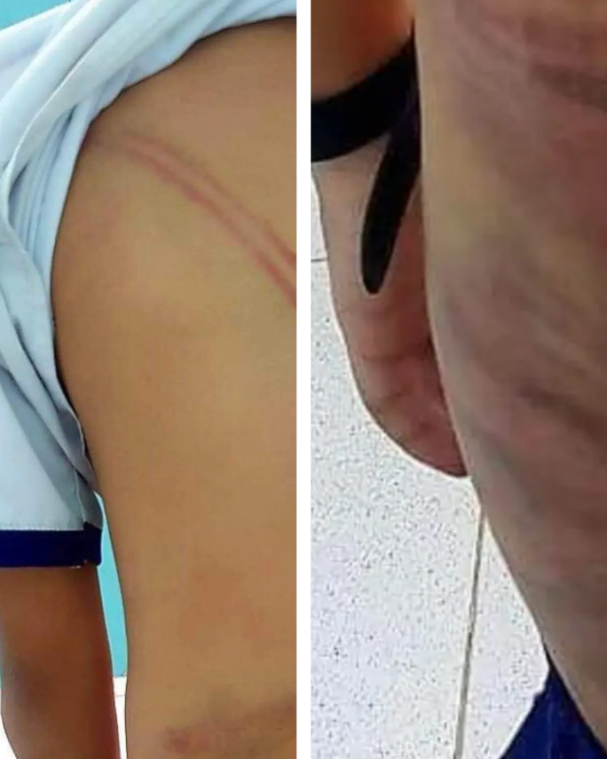 Cấm đi khỏi nơi cư trú đối với mẹ kế đánh dã man con chồng