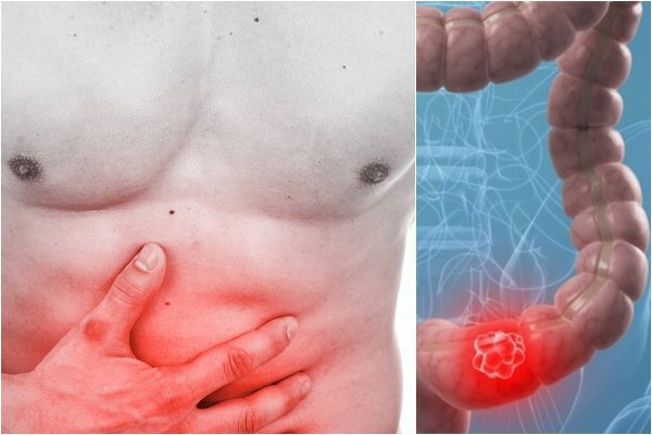 Có nên giấu bệnh với người bị ung thư?