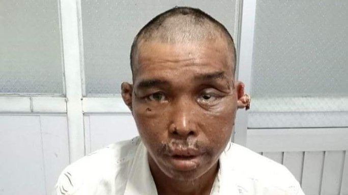 Ngư dân bị hành hạ dã man trên tàu cá giờ ra sao?