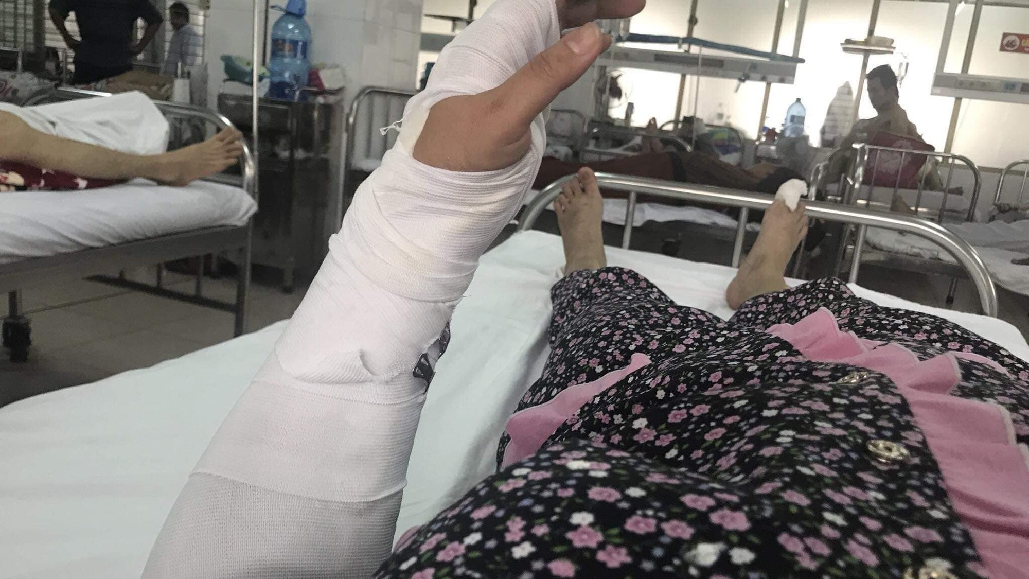 Điều tra vụ chồng đ&aacute;nh vợ d&atilde; man tại Đ&agrave; Nẵng - Ảnh 1.