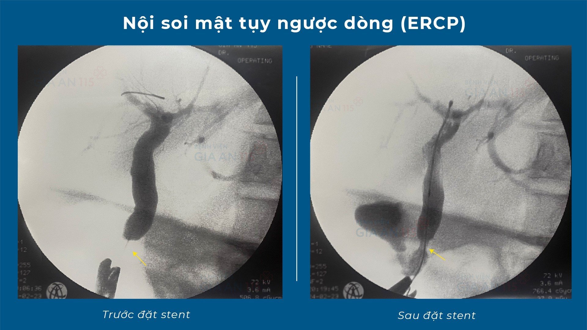 Bác sĩ "cân não" với ca bệnh 25 năm mới gặp trong nghề