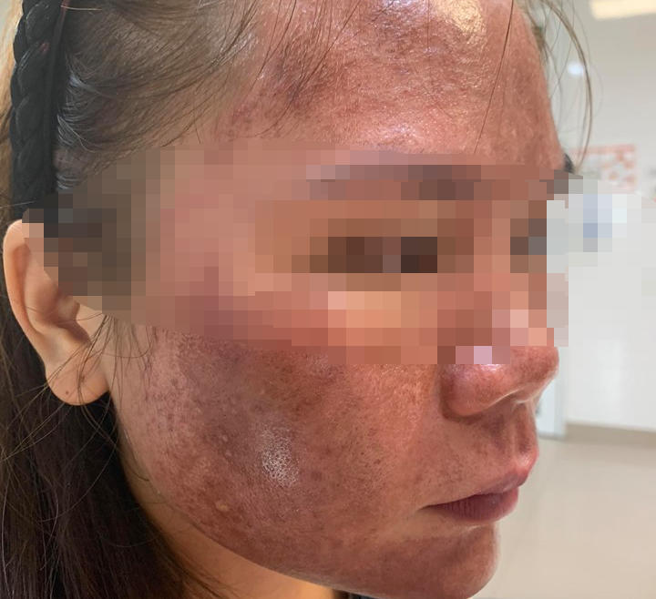 L&agrave;m đẹp da đi dự sự kiện, c&ocirc; g&aacute;i trẻ kh&ocirc;ng d&aacute;m soi gương - Ảnh 3.