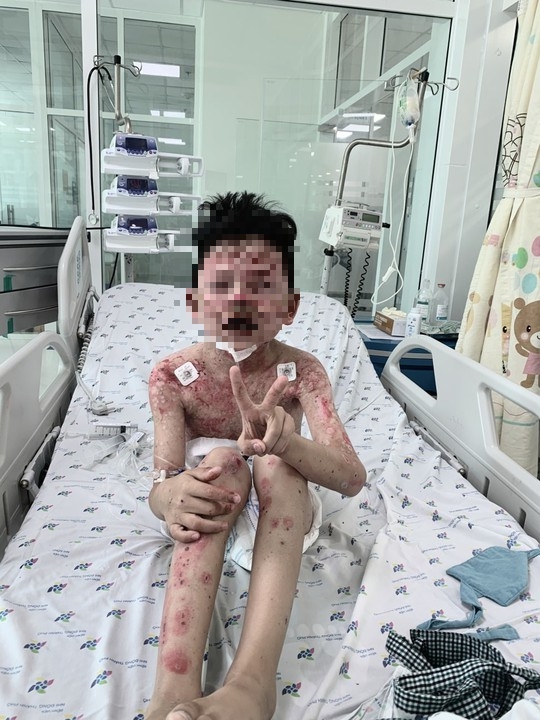 Sau 2 ngày ăn cua, bé trai nguy kịch - Ảnh 3.
