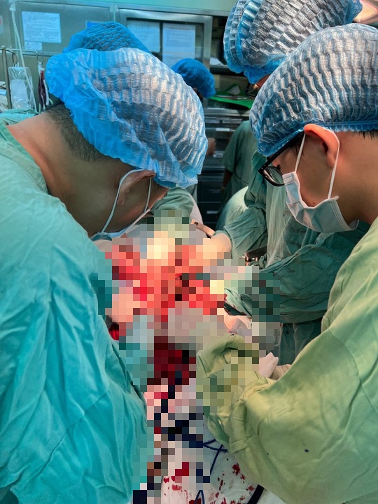 H&agrave;nh tr&igrave;nh cứu sống chủ tịch phường bị đ&acirc;m 4 nh&aacute;t dao - Ảnh 2.