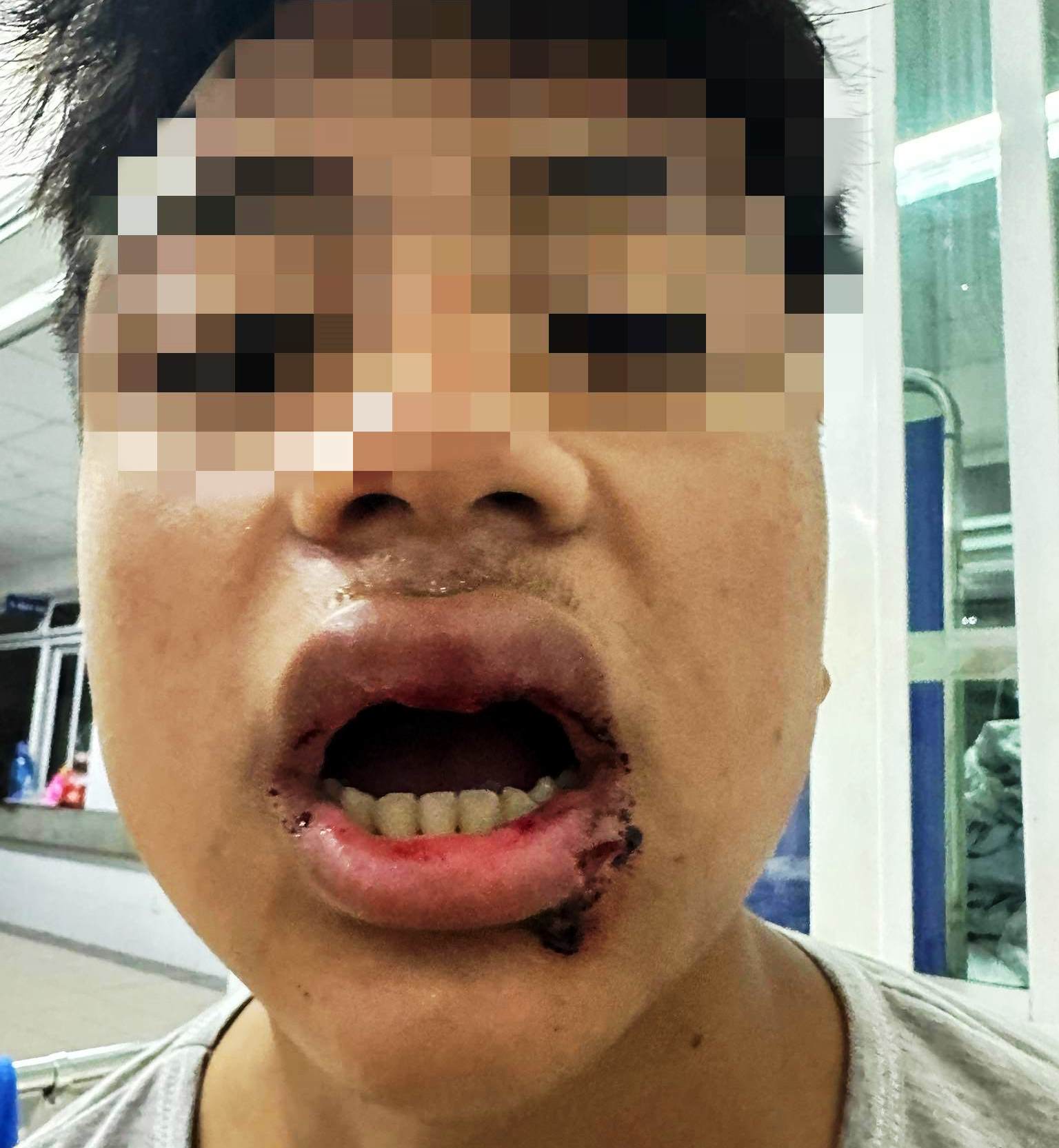 Bị đ&aacute;nh khi đi tắm biển, nam sinh k&ecirc;u cứu tr&ecirc;n mạng x&atilde; hội - Ảnh 3.