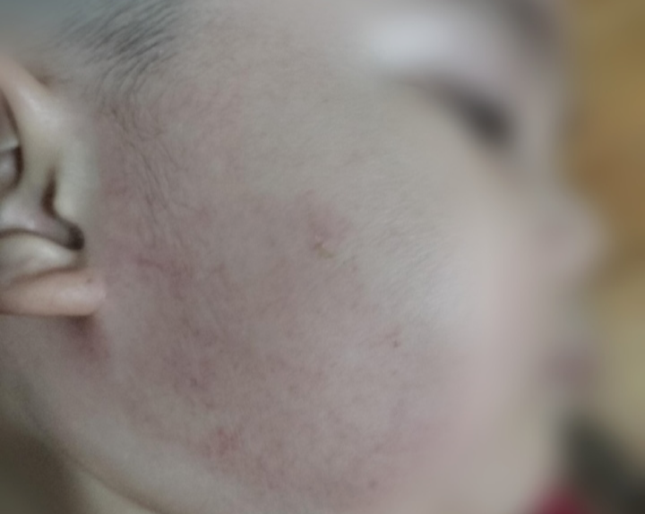 Phẫn nộ cô giáo mầm non tát bé trai 31 cái trong lúc ăn