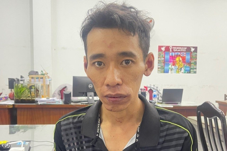 Bắt giữ t&ecirc;n cướp giật d&acirc;y chuyền khiến người phụ nữ ngơ ng&aacute;c nh&igrave;n theo - Ảnh 1.