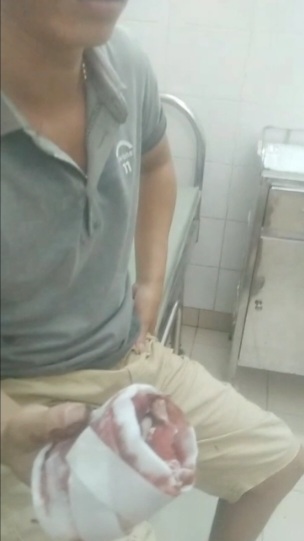 Sáng tỏ vụ chậm phẫu thuật cho bệnh nhân bị dập nát 2 đốt ngón tay - Ảnh 3.