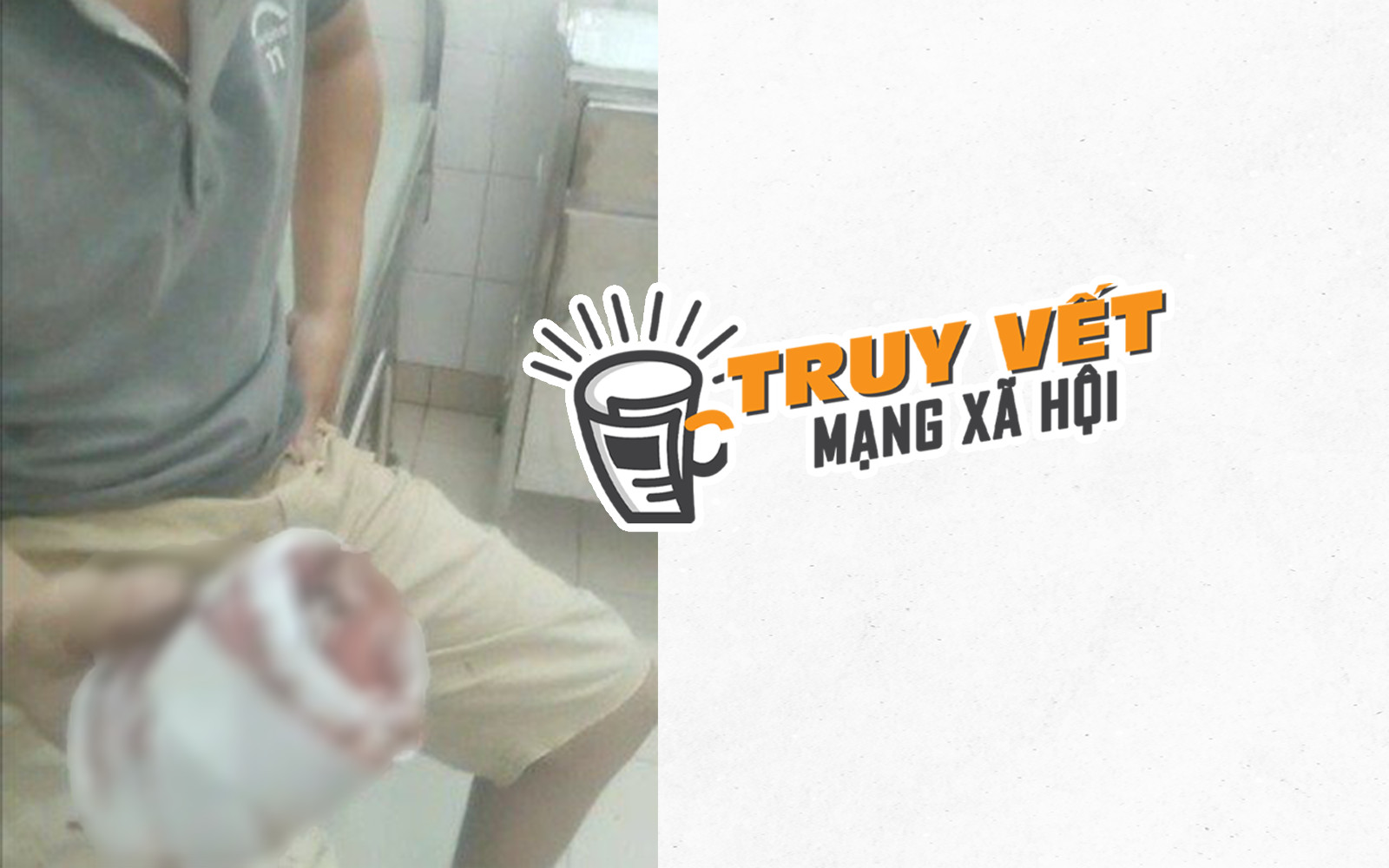 Sáng tỏ vụ "chậm phẫu thuật cho bệnh nhân bị dập nát 2 đốt ngón tay"