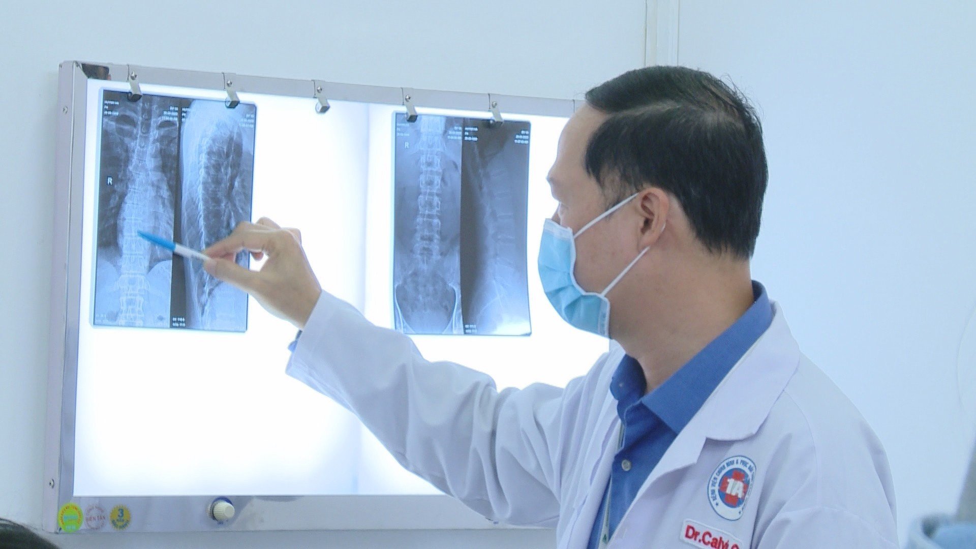 Lại th&ecirc;m thanh ni&ecirc;n nứt vỡ đốt sống ngực v&igrave; nắn bẻ khớp - Ảnh 2.