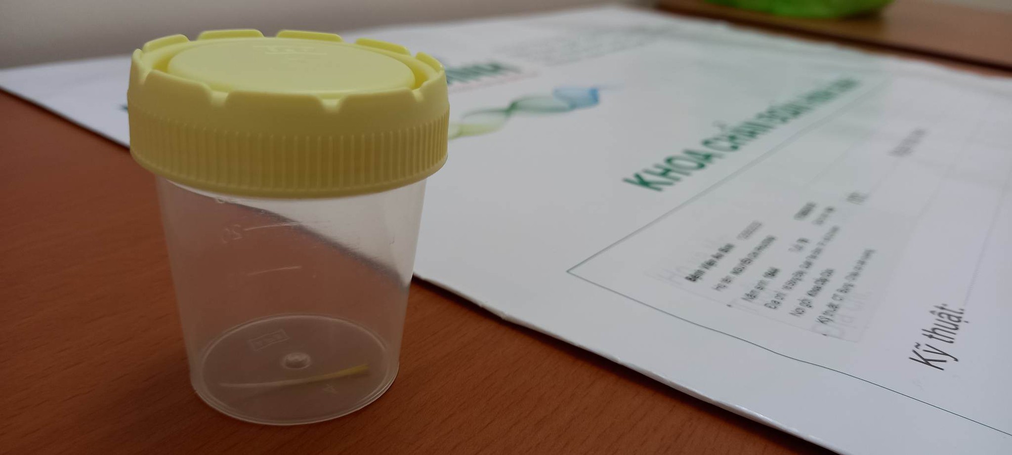 Vào viện cấp cứu mới biết đã nuốt phải mẩu xương dài 5 cm