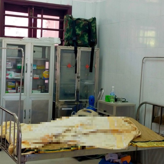 Thợ x&acirc;y tử vong nghi bị ngộ độc hải sản