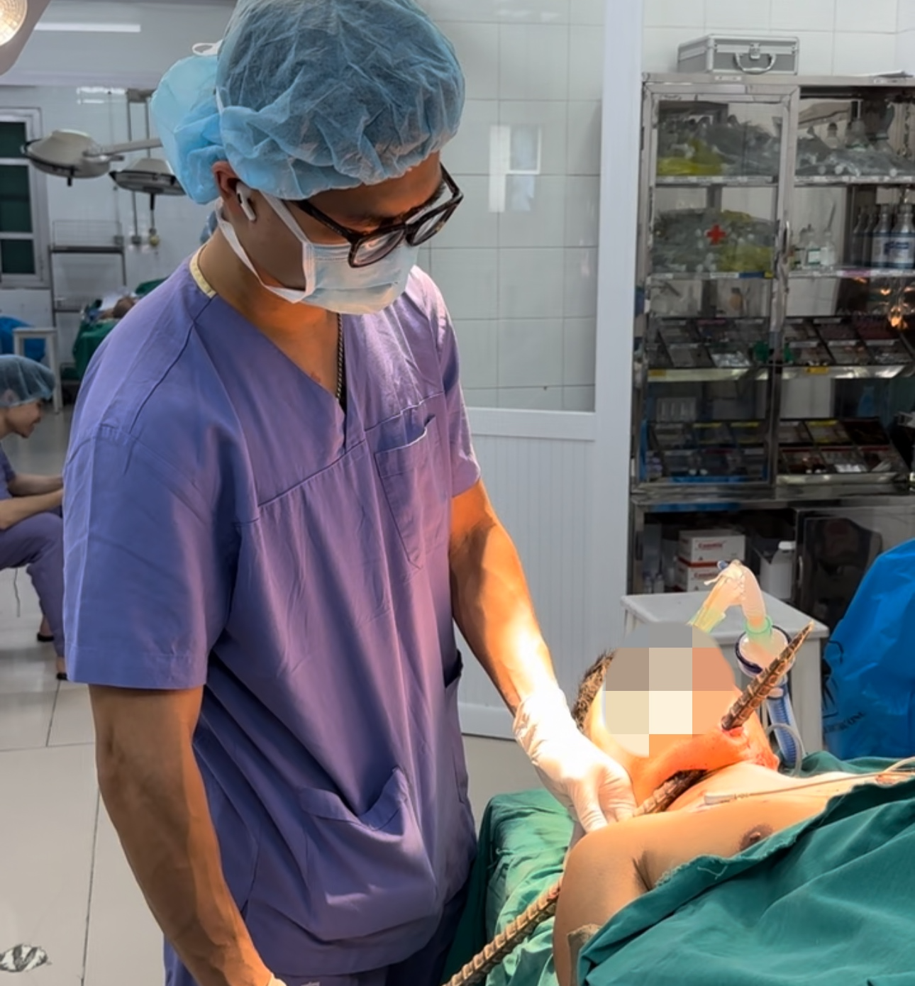 Vấp ng&atilde;, người đ&agrave;n &ocirc;ng bị thanh x&agrave; beng d&agrave;i cả m&eacute;t đ&acirc;m xuy&ecirc;n cổ - Ảnh 1.
