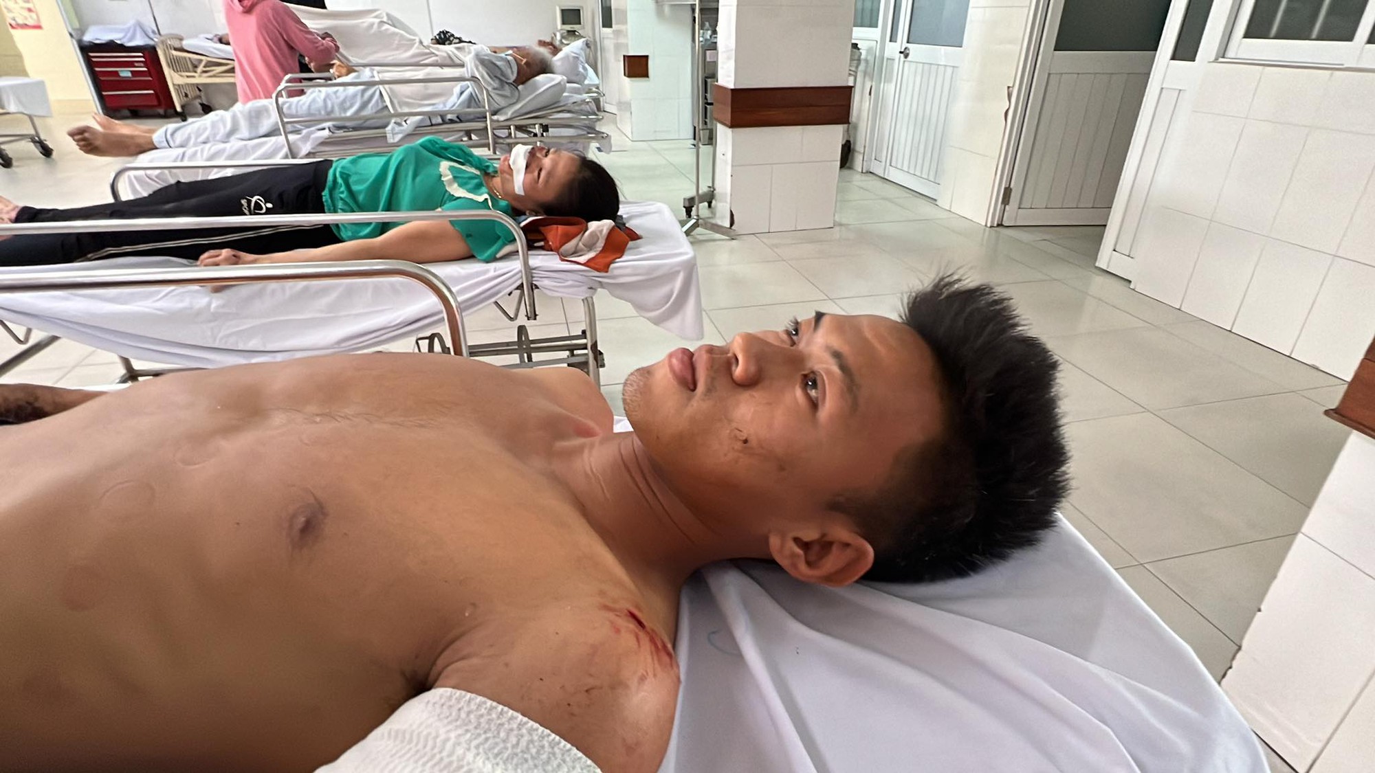 Sau tai nạn, THACO sẽ tài trợ xe mới cho đội trẻ Quảng Nam