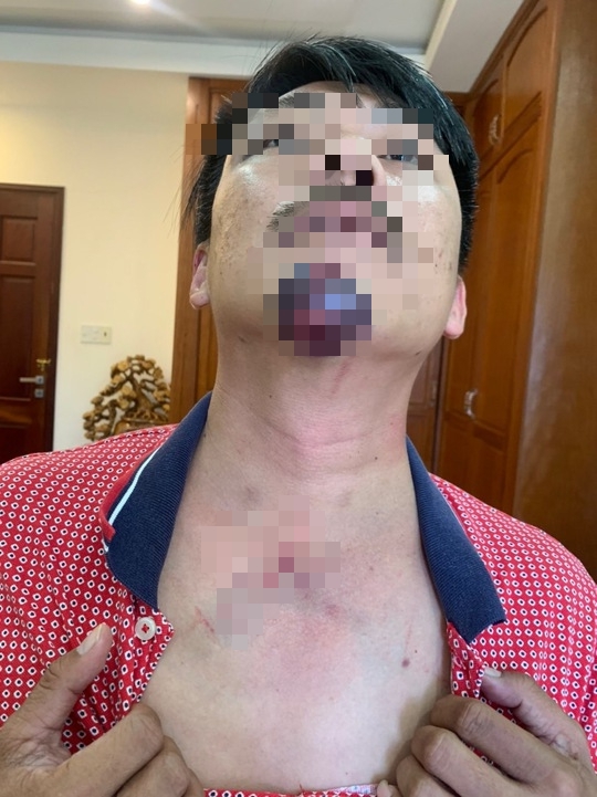 Chuyển Cơ quan Điều tra VKSND Tối cao vụ c&ocirc;ng an bị tố d&ugrave;ng nhục h&igrave;nh ở Ph&uacute; Quốc - Ảnh 3.