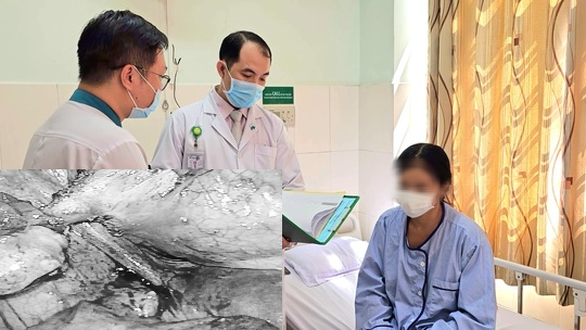 Nữ bệnh nhân mắc chứng bệnh hiếm gặp, đi tiểu ra những sợi tóc
