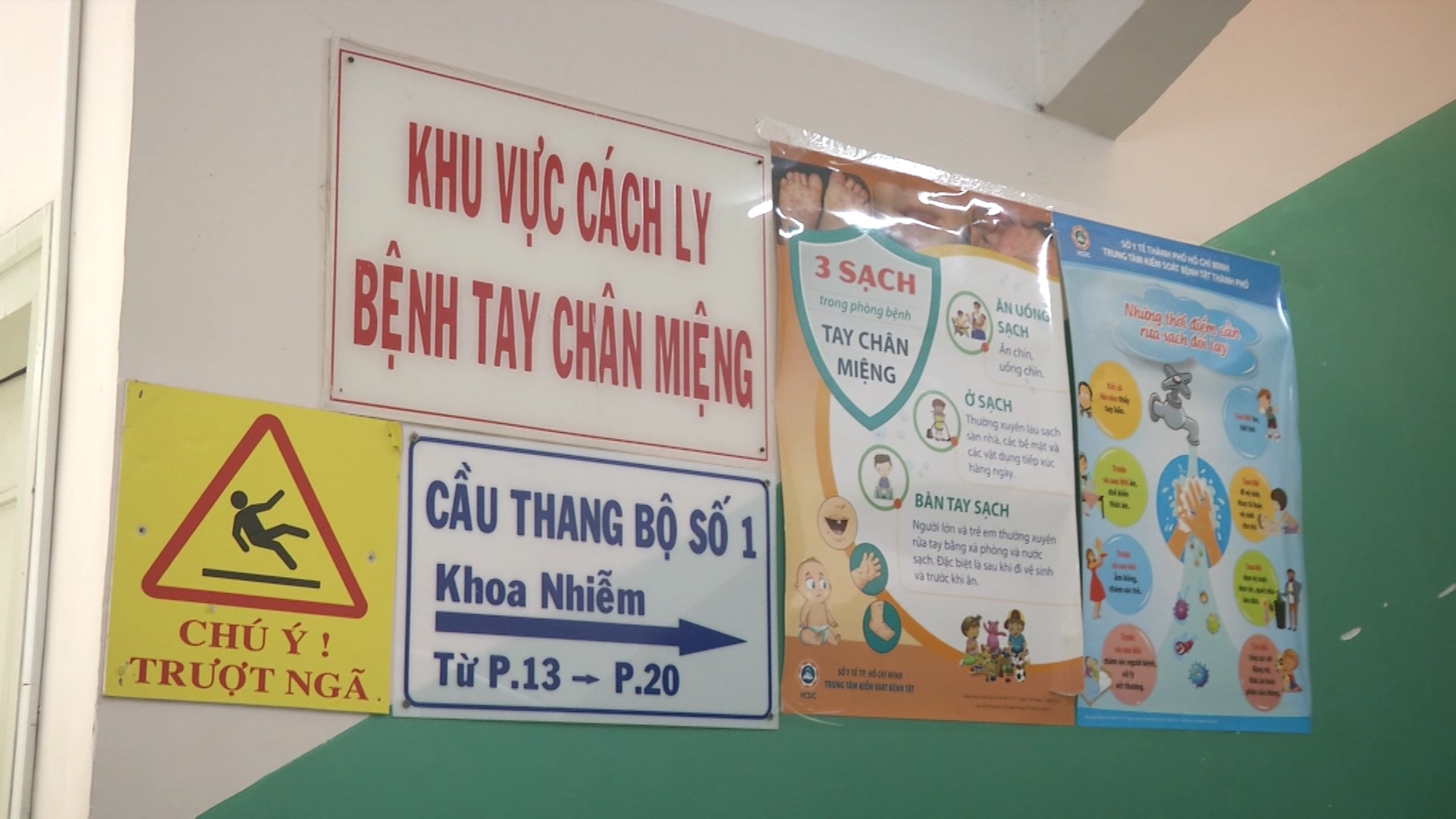 Bệnh nhi 17 tháng tuổi bị tay chân miệng chuyển độ nặng, phải thở máy