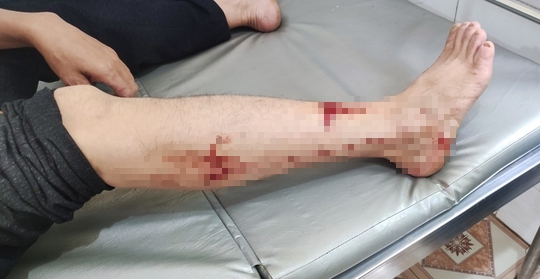 Voọc đen má trắng quý hiếm bất ngờ tấn công người, gây thương tích