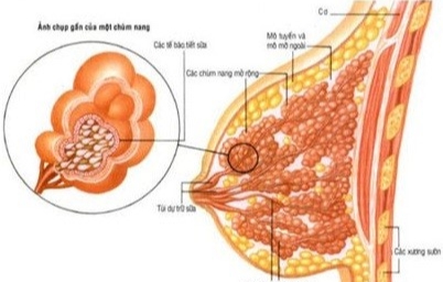 Đang cho con bú có uống thuốc hạ sốt được không?