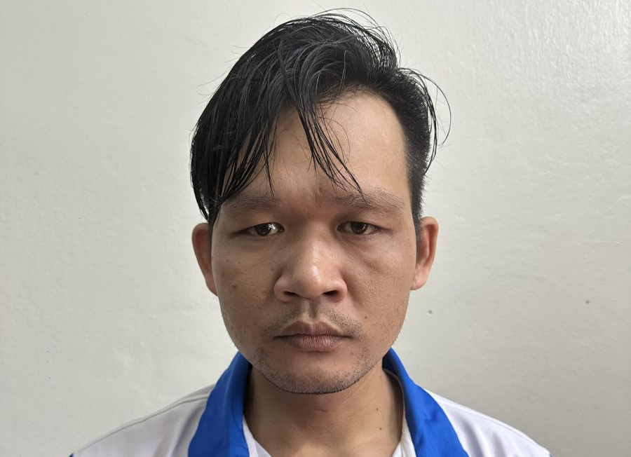 Chồng tạt axit vào mặt vợ khiến 2 mắt nguy cơ mù lòa vĩnh viễn