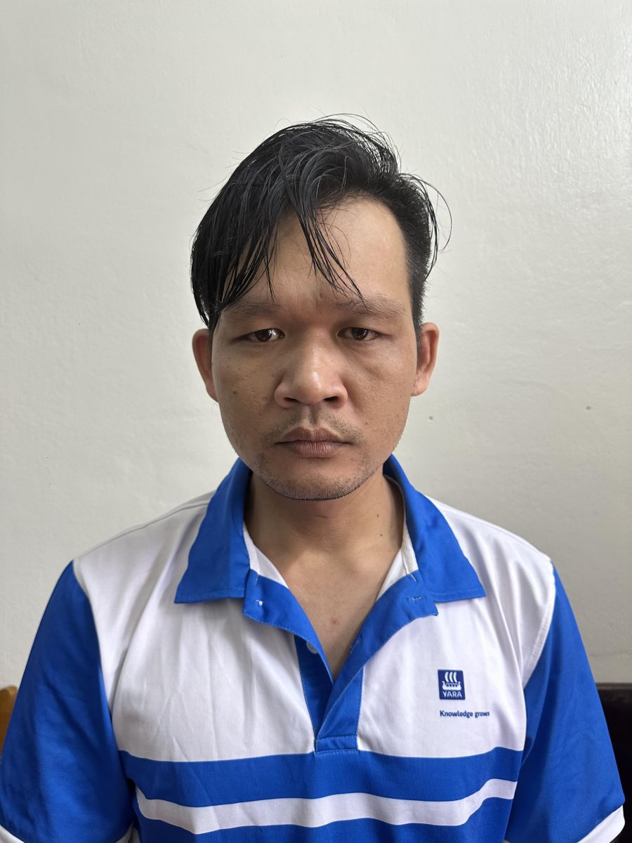 Chồng tạt axit v&agrave;o mặt vợ khiến 2 mắt nguy cơ m&ugrave; l&ograve;a vĩnh viễn - Ảnh 1.