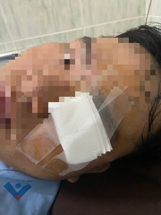Nam thanh ni&ecirc;n nhập viện v&igrave; va v&agrave;o gậy của CSGT n&oacute;i g&igrave;? - Ảnh 1.