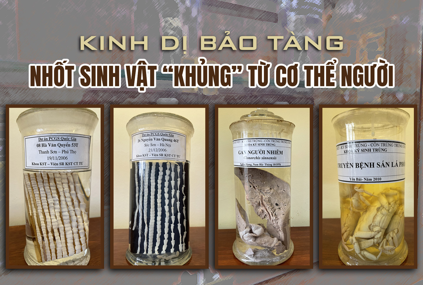 Kinh dị bảo t&agrave;ng nhốt sinh vật &ldquo;khủng&rdquo; từ cơ thể người