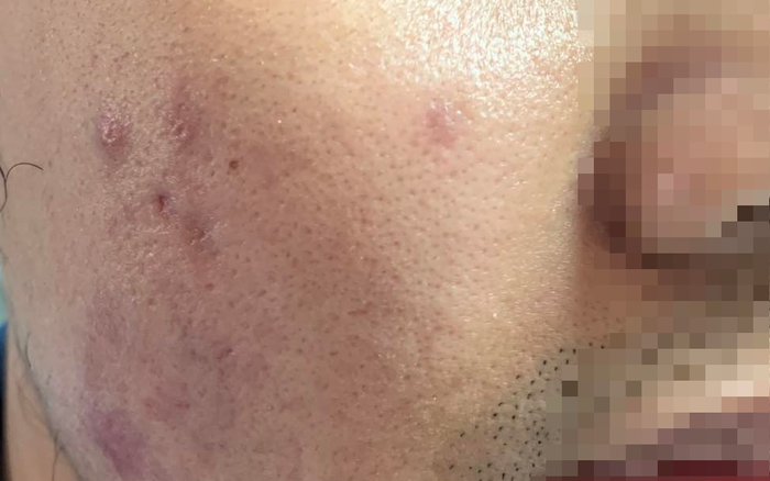 Siết chặt dịch vụ l&agrave;m đẹp b&igrave;nh d&acirc;n