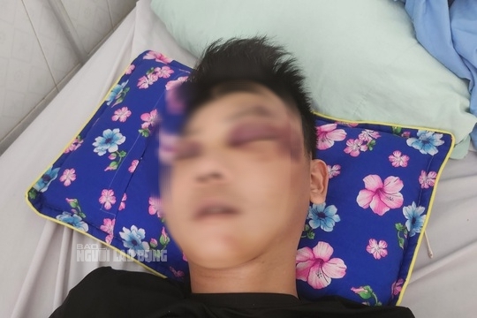 Tình hình sức khỏe thanh niên bị đá, đạp dã man vào đầu, bất tỉnh trên quốc lộ - Ảnh 3.