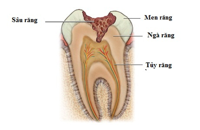 Đừng lơ là việc khám răng định kỳ - Ảnh 1.