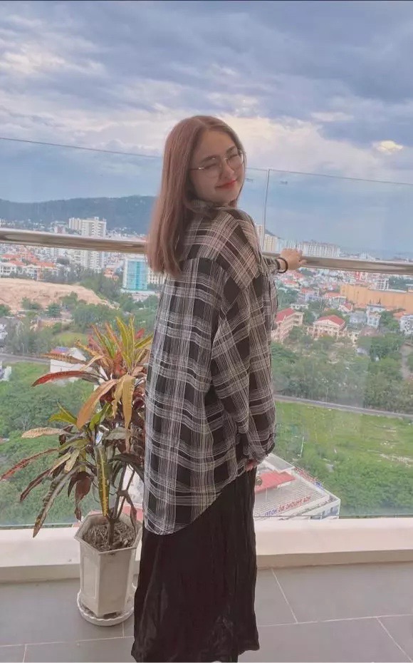 Ca sĩ Thiện Nh&acirc;n khiến d&acirc;n mạng bất ngờ v&igrave; ngoại h&igrave;nh kh&aacute;c lạ - Ảnh 1.